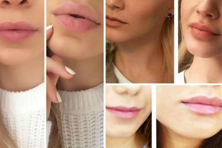 Consigue unos labios voluminosos